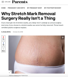 Laser Stretch Mark Removal in Hudson Valley, NY